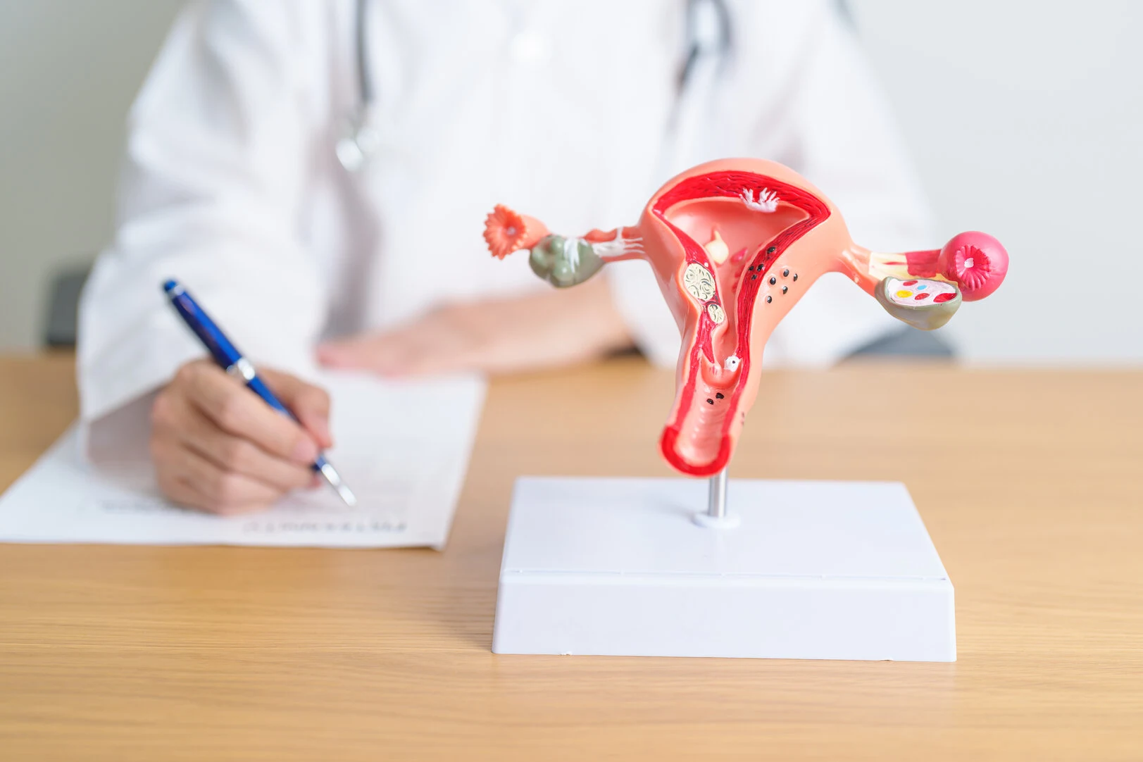 Endometriose