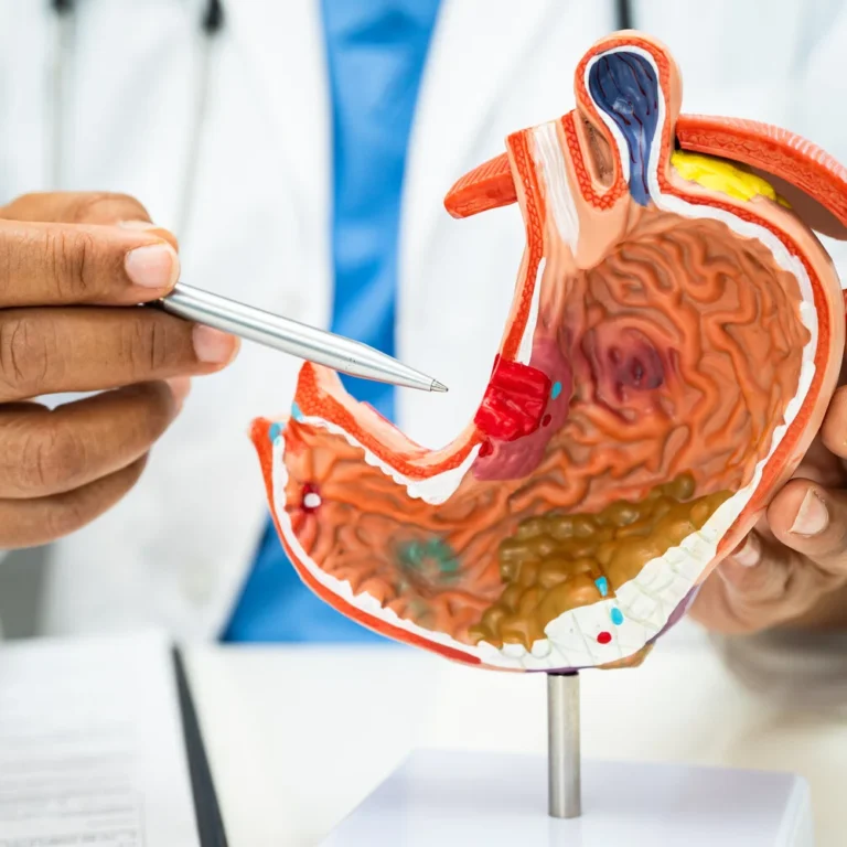 Bijwerkingen Famotidine