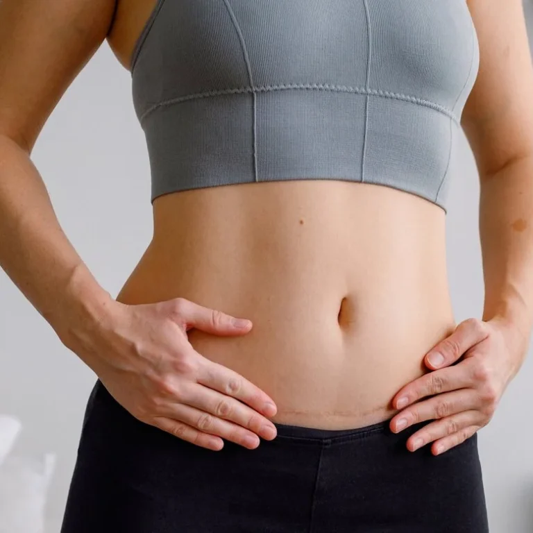 Bijwerkingen Pentasa