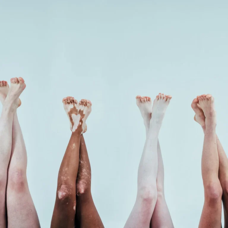 Bijwerkingen Trimethoprim