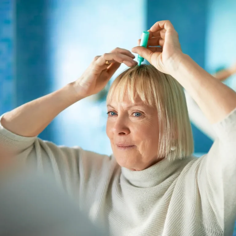 Haaruitval door overgang