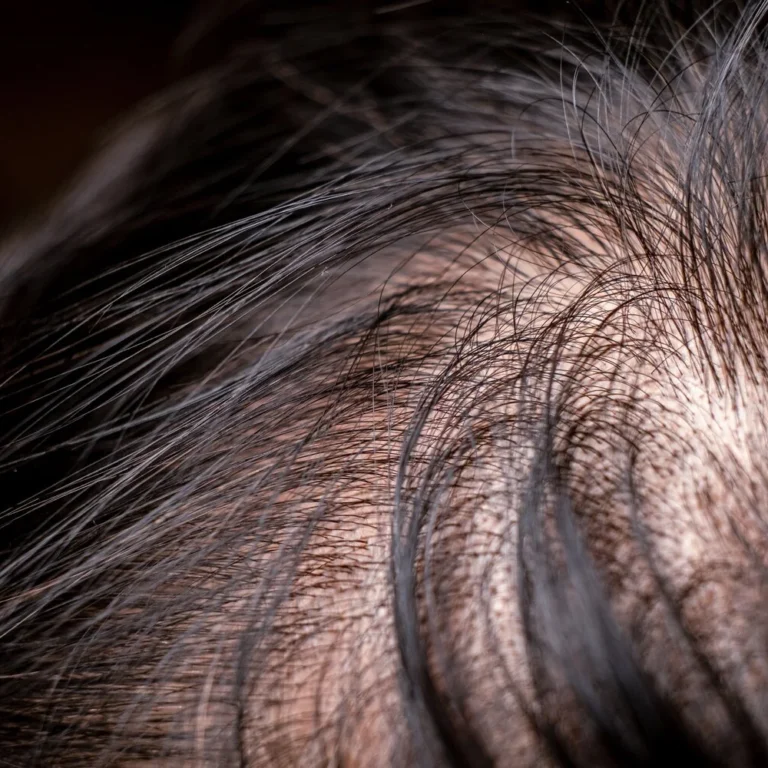 Hoeveel haren verlies je per dag