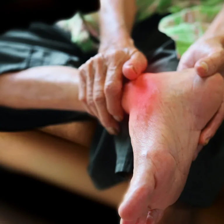 Welk fruit niet eten bij Jicht